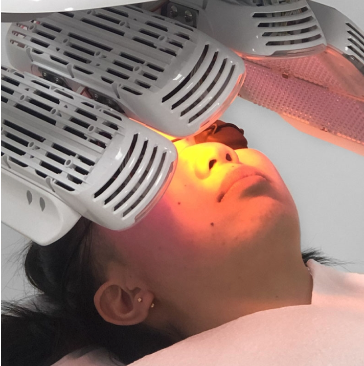 Micro Facial + LED + Extractions