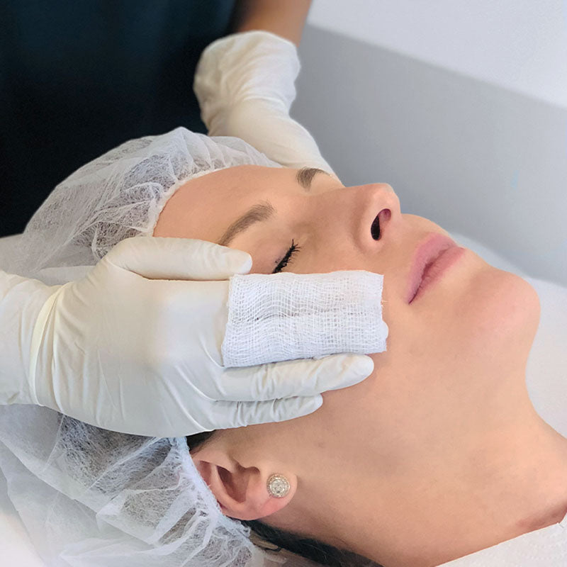 Chemical Peel - Rejuvenation Age Peel + LED Light Therapy