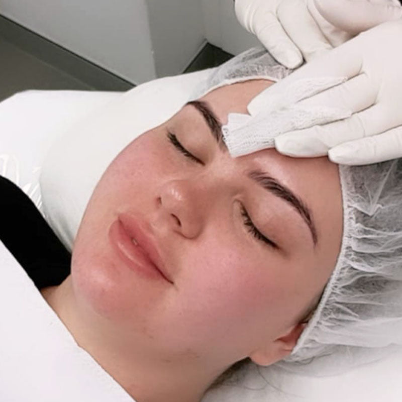 Chemical Peel - Pigmentation White Peel + LED Light Therapy