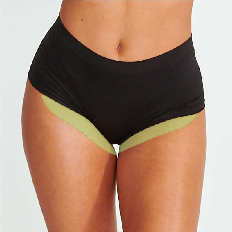 Laser Hair Removal-Bikini Line (Female)