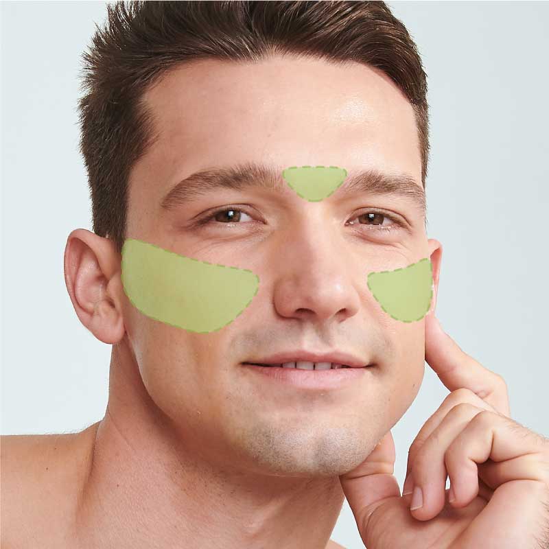 Laser Hair Removal-Cheeks + Midbrow