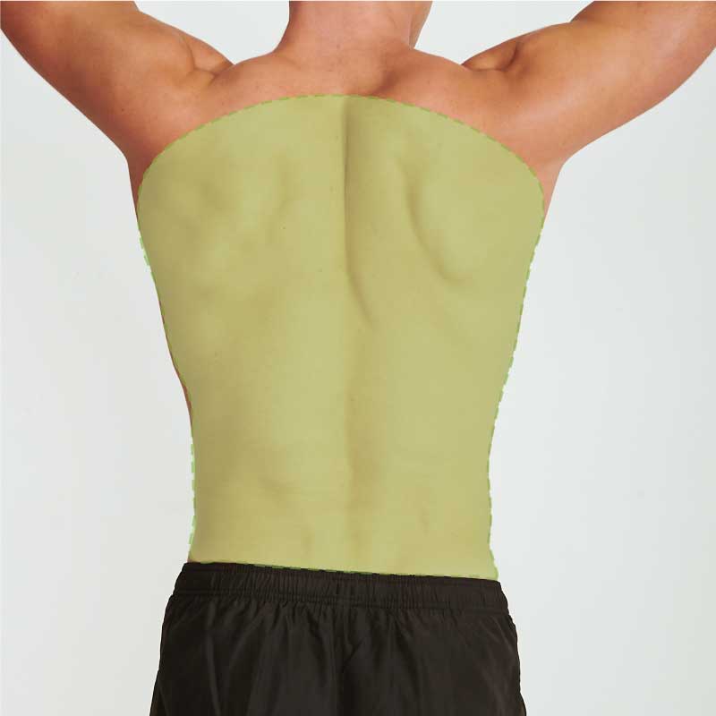 Laser Hair Removal-Full Back