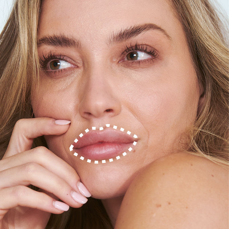 Lip Fillers Consultation Free