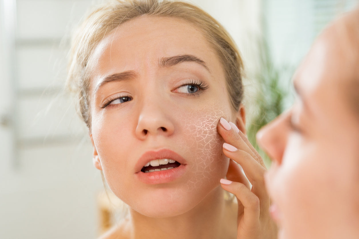 Understanding and Combating Dry Skin: A Woman's Guide