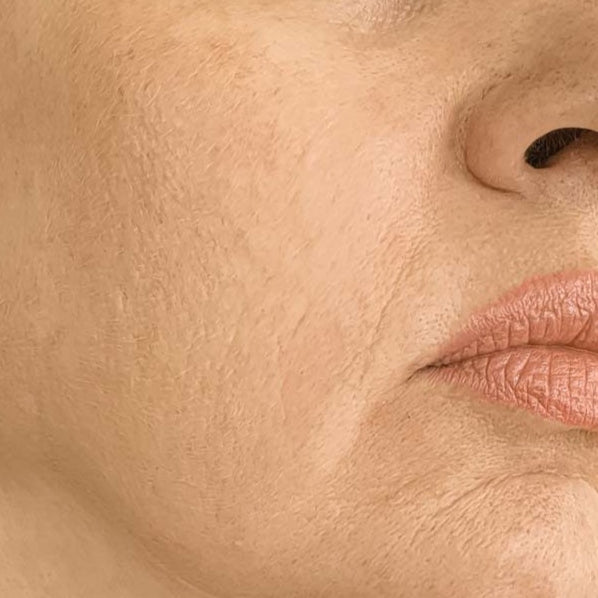 Close-up of mature skin with fine lines around the cheek and mouth