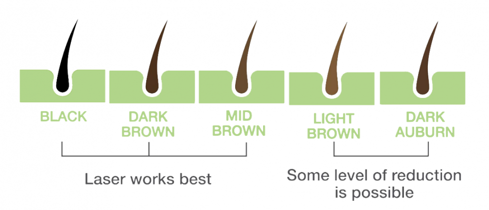 Hair colour chart: laser works best on black, dark brown and mid brown hair; some reduction is possible on light brown and dark auburn hair