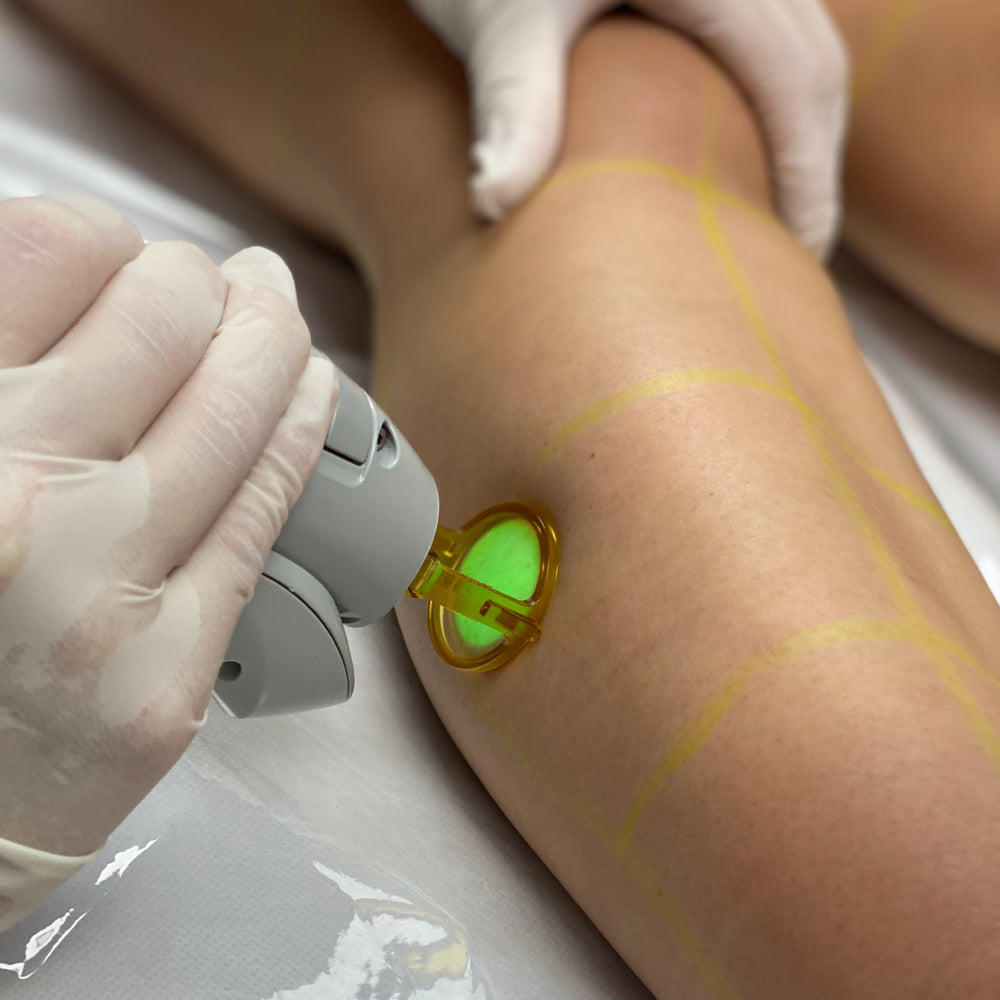 Clinician treating a client's leg with a laser hair removal handpiece
