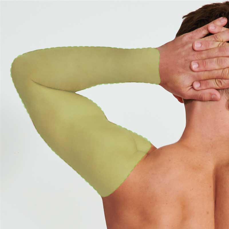 Full arm treatment area highlighted